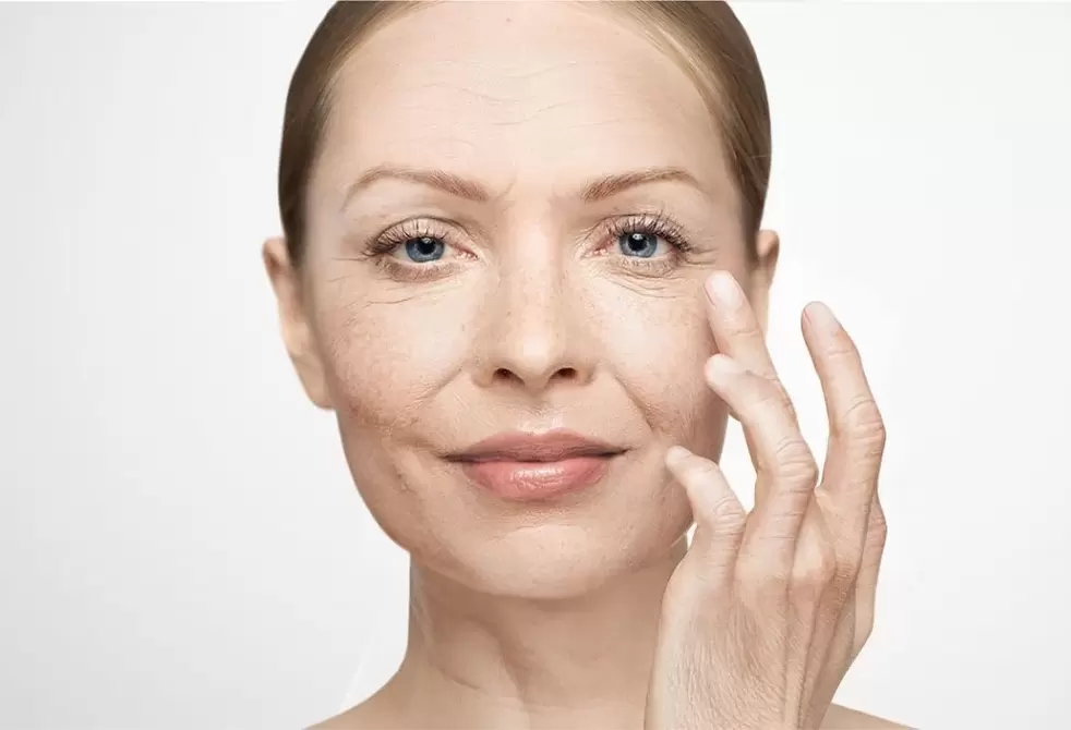 Arrugas en el rostro y su eliminación con crema Eudalie.