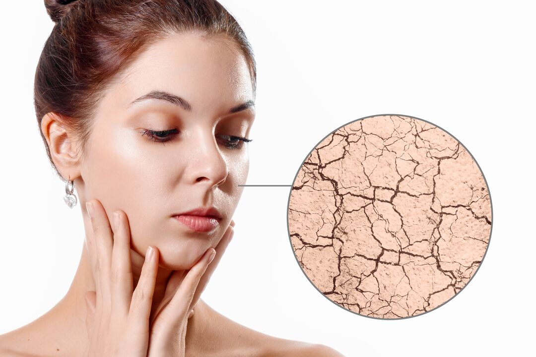 Hidratar la piel seca con la crema Eudalie.