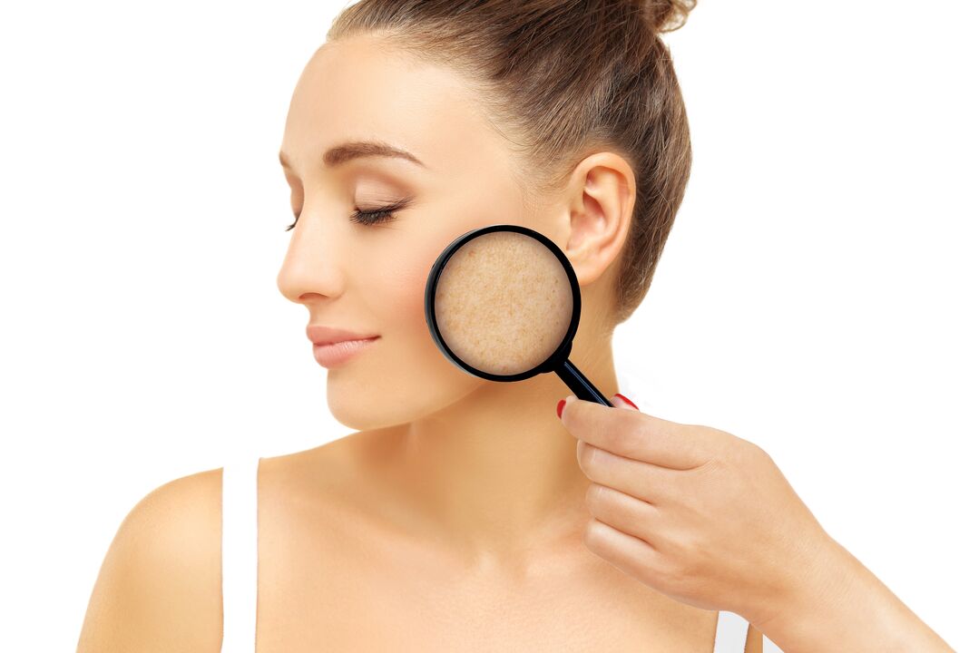 deshacerse de las manchas de la edad con la crema Eudalie
